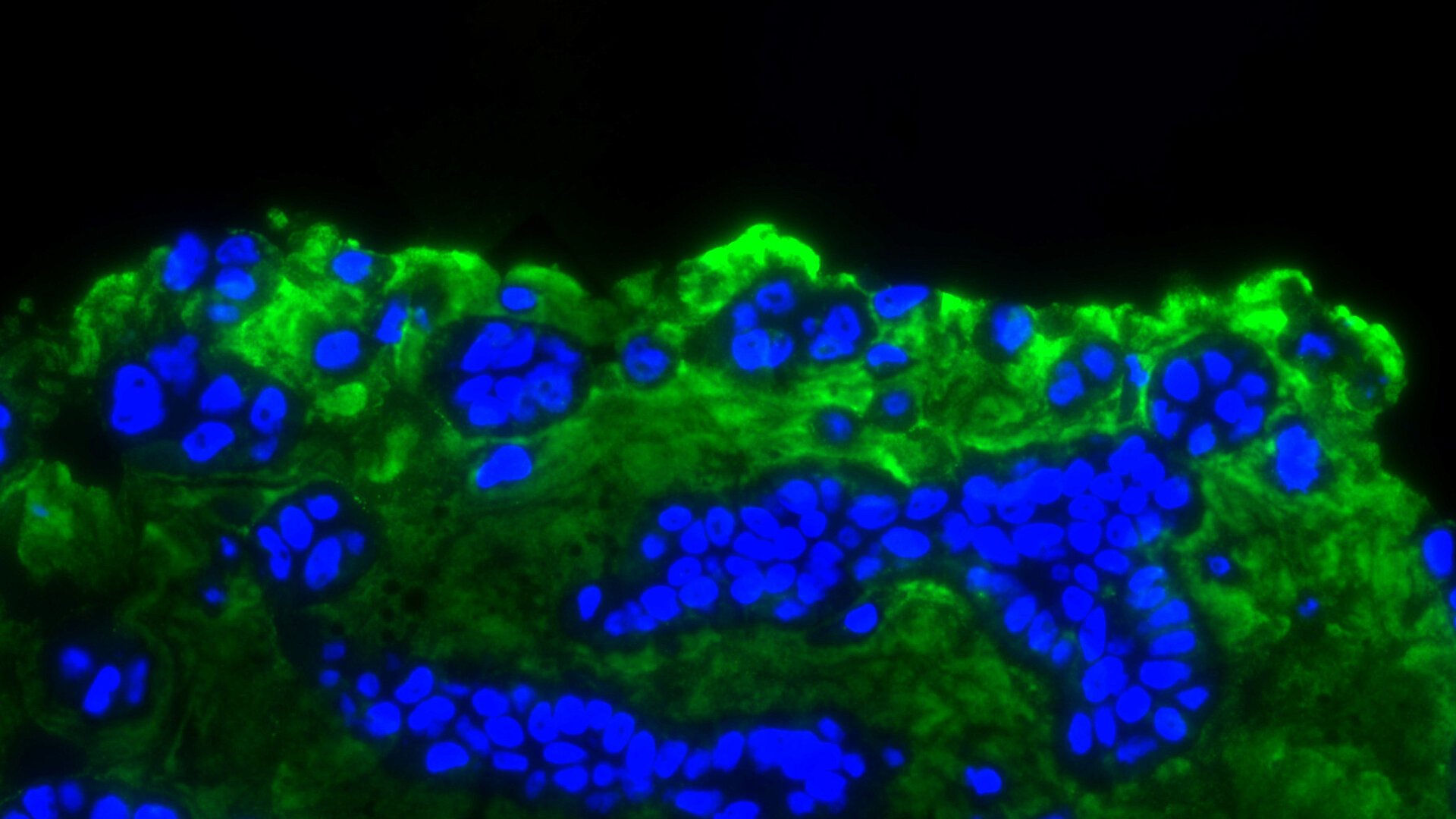 Image taken with a fluorescence microscope